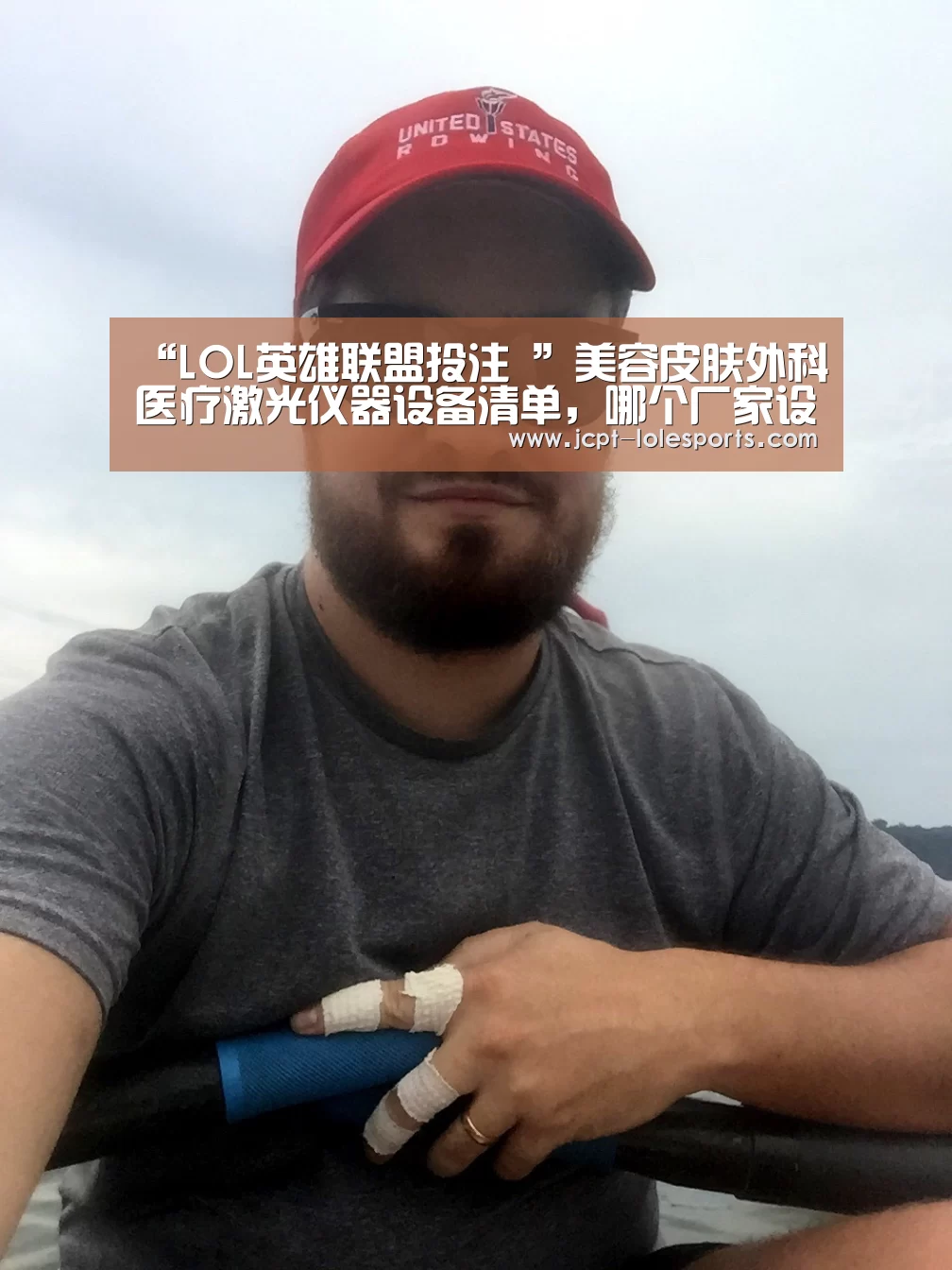 “LOL英雄联盟投注 ”美容皮肤外科医疗激光仪器设备清单,哪个厂家设备齐全(图3) LOL英雄联盟投注